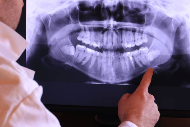 Best Pediatric Emergency Dentist in Houghton, MI