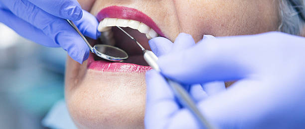 Best Emergency Tooth Extraction in Houghton, MI